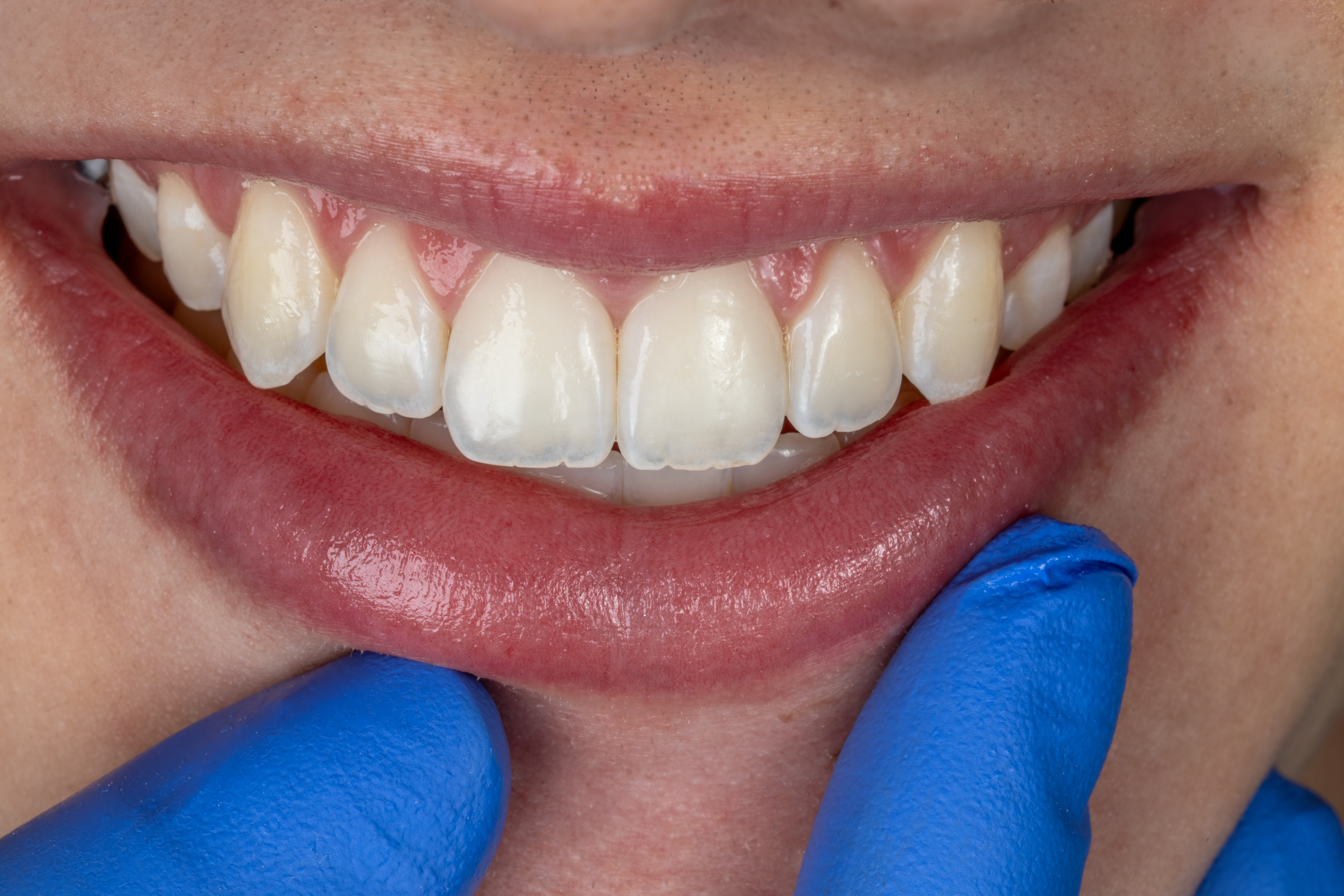 Transformaciones Reales Injoe Dental