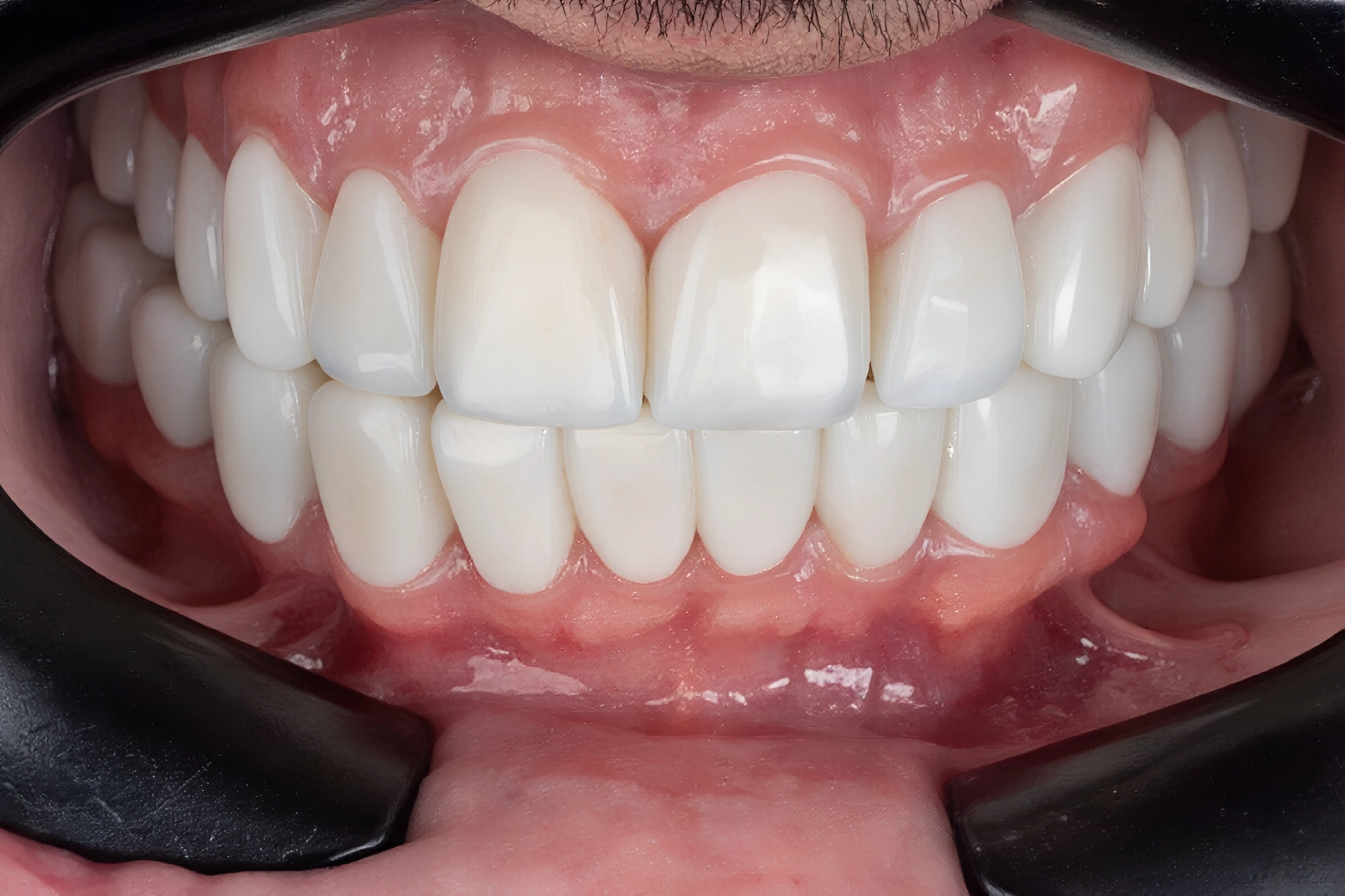 Diseño de Sonrisa