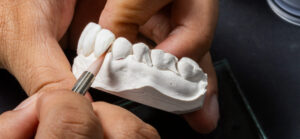 Resultado Dental 3