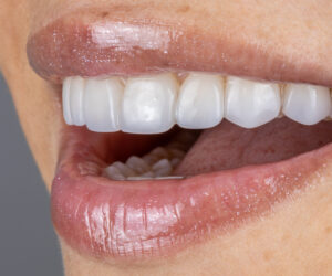 Resultado Dental 2